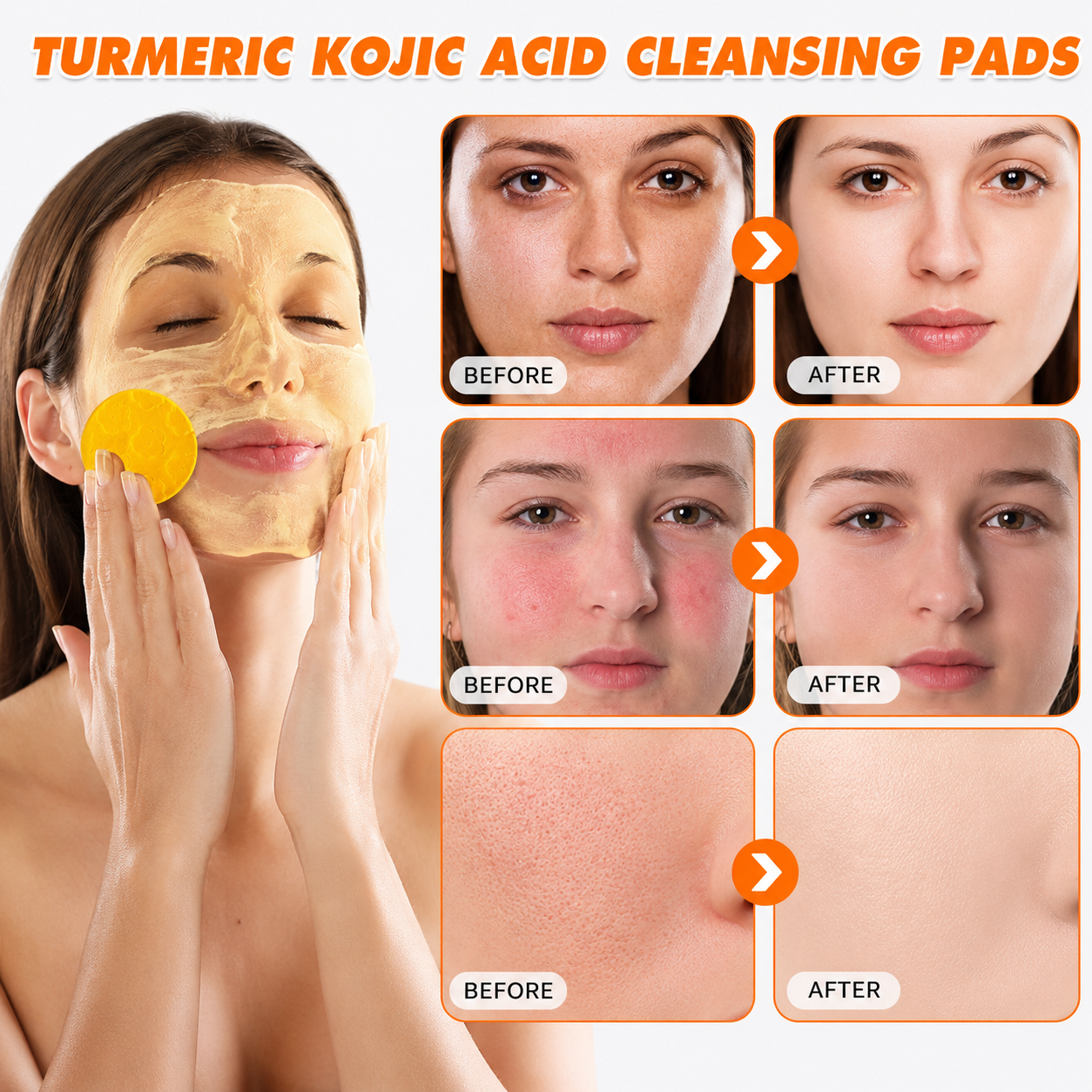 🔥Last Day Big Discount Promotion🔥 | Nativezi Turmeric Kojic Glow Pads