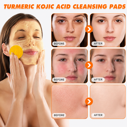 🔥Last Day Big Discount Promotion🔥 | Nativezi Turmeric Kojic Glow Pads
