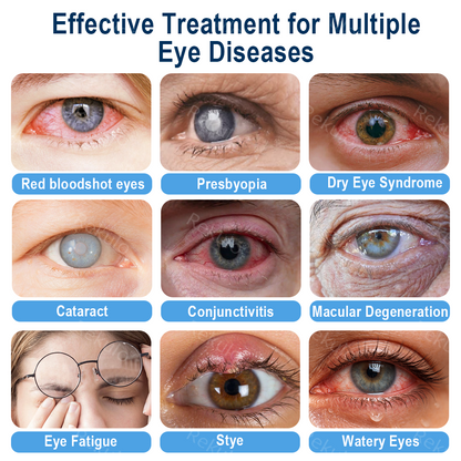 OptiMist Eye Spray✅Approved (For dry eyes, blurry vision, eye strain, presbyopia, and cataracts) 👀 🌿